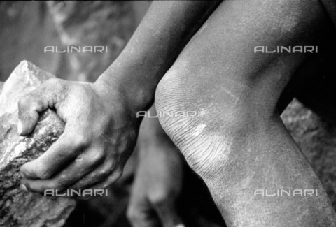 APN-F-027130-0000 - Guruwe  Zimbabwe  2004. A stone miner at work. Miner  labourer  poverty  stone  rock  hands.Athol Rheeder/South. - AfriLife / Africamediaonline/Archivi Alinari, Firenze