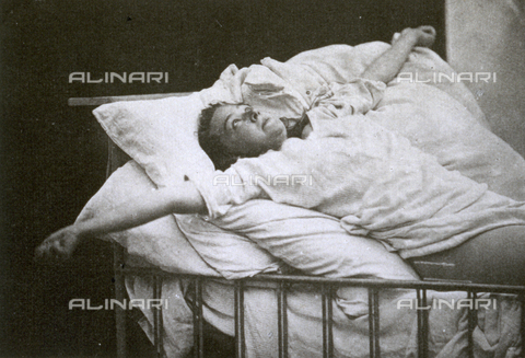 AVQ-A-000200-0027 - Young woman having a violent attack of convulsive hysteria. The patient is in the so-called crucifix position - Date of photography: 1878 - Verchi Marialieta Collection / Alinari Archives, Florence