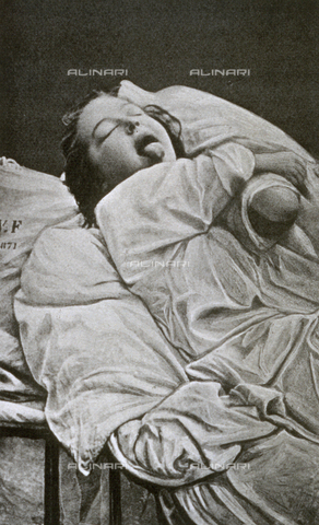 AVQ-A-000200-0030 - Young woman affected by convulsive hysteria. The patient is in the initial phase of a violent fit - Date of photography: 1878 - Verchi Marialieta Collection / Alinari Archives, Florence