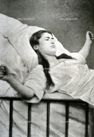AVQ-A-000200-0039 - Young woman having a violent attack of hysteria. The patient is lying on a bed, with her arms open, in a clear state of ecstasy - Date of photography: 1878 - Verchi Marialieta Collection / Alinari Archives, Florence