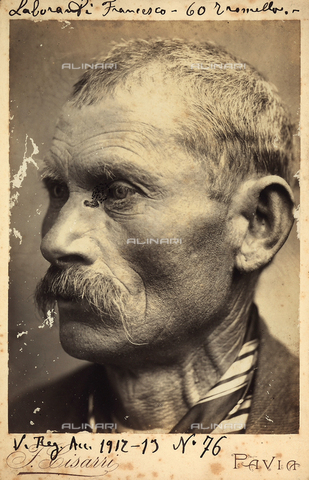 BCC-F-001075-0000 - Portrait of Francesco Laboranti aged 60, suffering from an eye disease - Date of photography: 1912-1913 - Alinari Archives, Florence