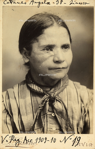 BCC-F-001080-0000 - Portrait of Angela Cattaneo, aged 38, suffering from a facial disease - Date of photography: 1909-1910 - Alinari Archives, Florence