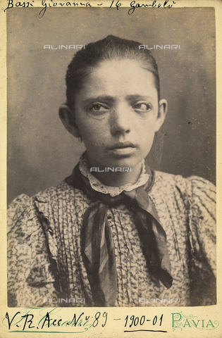 BCC-F-001082-0000 - Portrait of Giovanna Bassi, age 16, affected by a skin disease, around the eyes - Date of photography: 1900-1901 - Alinari Archives, Florence